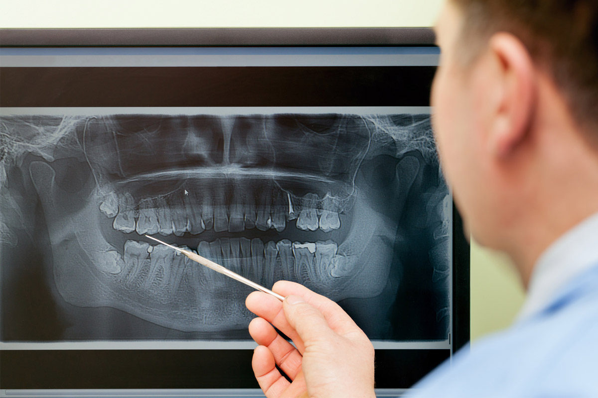 健康保険が適用される矯正歯科があることをご存知ですか？