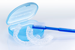 非抜歯での矯正治療