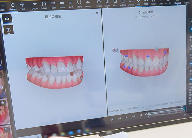 3Dシミュレーション