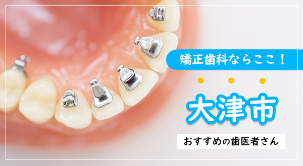 【2023年】大津市の矯正歯科ならここ！おすすめの歯医者さん
